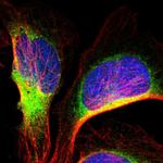 IER3IP1 Polyclonal Antibody