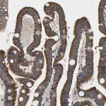 EMC7 Antibody in Immunohistochemistry (Paraffin) (IHC (P))