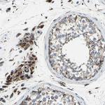 EMC7 Antibody in Immunohistochemistry (Paraffin) (IHC (P))