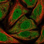 TIM17 Polyclonal Antibody