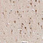 TIM17 Antibody in Immunohistochemistry (Paraffin) (IHC (P))