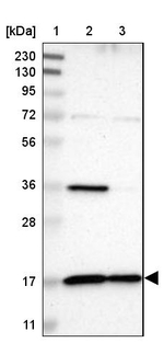 TIM17 Antibody in Western Blot (WB)