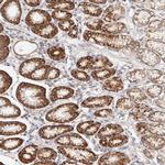 GNA13 Antibody in Immunohistochemistry (IHC)