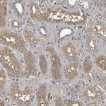 GAB3 Antibody in Immunohistochemistry (Paraffin) (IHC (P))