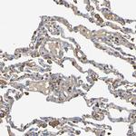 GAB3 Antibody in Immunohistochemistry (Paraffin) (IHC (P))