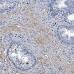 GAB3 Polyclonal Antibody