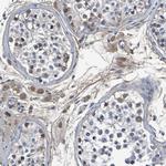 GAB3 Antibody in Immunohistochemistry (Paraffin) (IHC (P))