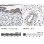GRAMD3 Antibody in Immunohistochemistry (IHC)
