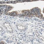 GRAMD3 Antibody in Immunohistochemistry (IHC)