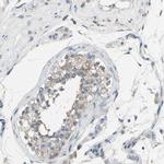 GRAMD3 Antibody in Immunohistochemistry (IHC)