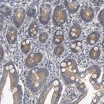 PCDH8 Antibody in Immunohistochemistry (Paraffin) (IHC (P))