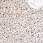 LECT1 Polyclonal Antibody