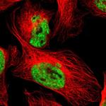 WTAP Polyclonal Antibody