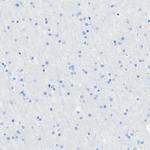 MFAP5 Antibody in Immunohistochemistry (Paraffin) (IHC (P))