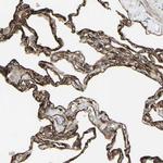 DTX3L Antibody in Immunohistochemistry (Paraffin) (IHC (P))