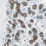 TIMM21 Antibody in Immunohistochemistry (Paraffin) (IHC (P))