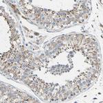GLT8D1 Antibody in Immunohistochemistry (Paraffin) (IHC (P))