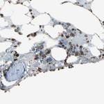 PSTPIP1 Antibody in Immunohistochemistry (IHC)