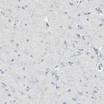 PSTPIP1 Antibody in Immunohistochemistry (IHC)