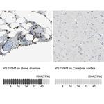 PSTPIP1 Antibody
