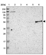PSTPIP1 Antibody in Western Blot (WB)
