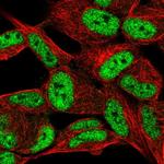 C12orf53 Antibody in Immunocytochemistry (ICC/IF)
