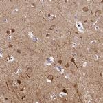 C12orf53 Antibody in Immunohistochemistry (IHC)