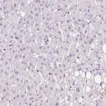 C12orf53 Antibody in Immunohistochemistry (IHC)