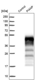 C12orf53 Antibody in Western Blot (WB)