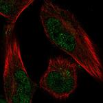 FAM189A1 Polyclonal Antibody