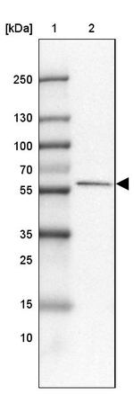 FAM189A1 Antibody in Western Blot (WB)