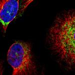 CLPP Polyclonal Antibody