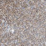 CLPP Antibody in Immunohistochemistry (IHC)