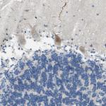 TMEM59L Antibody in Immunohistochemistry (Paraffin) (IHC (P))