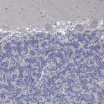 GLOD5 Antibody in Immunohistochemistry (Paraffin) (IHC (P))