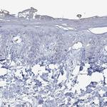 GLOD5 Antibody in Immunohistochemistry (Paraffin) (IHC (P))