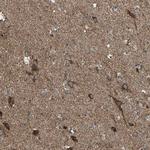 RHOT1 Antibody in Immunohistochemistry (IHC)