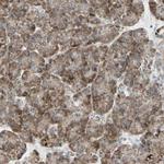RHOT1 Polyclonal Antibody