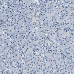 ATP1B2 Polyclonal Antibody
