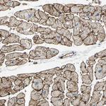 PRRG2 Antibody in Immunohistochemistry (Paraffin) (IHC (P))