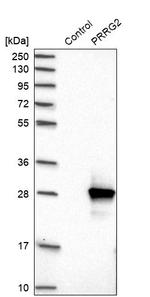 PRRG2 Antibody in Western Blot (WB)