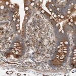 C1orf43 Antibody in Immunohistochemistry (Paraffin) (IHC (P))