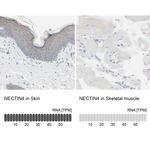 Nectin 4 Antibody in Immunohistochemistry (IHC)