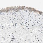 Nectin 4 Antibody in Immunohistochemistry (IHC)