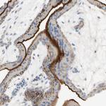 Nectin 4 Antibody in Immunohistochemistry (IHC)