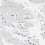 Nectin 4 Antibody in Immunohistochemistry (IHC)