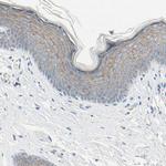 Nectin 4 Antibody in Immunohistochemistry (IHC)