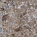 FAM163A Polyclonal Antibody