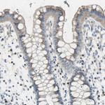 B4GALT3 Antibody in Immunohistochemistry (Paraffin) (IHC (P))