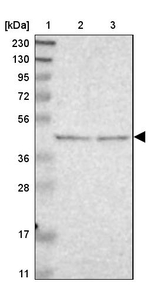 B4GALT3 Antibody in Western Blot (WB)